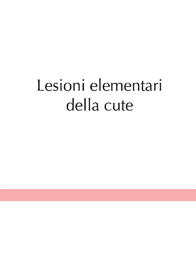 Lesioni elementari della cute