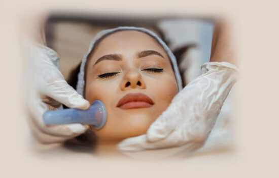 face cupping - coppettazione viso